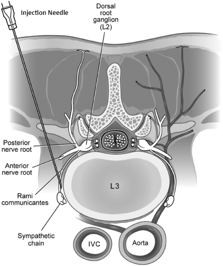 Sympathetic Chain Image3