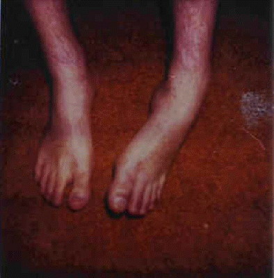 db_Leg_and_Foot_Deformity-Discoloration_Pics_copy1