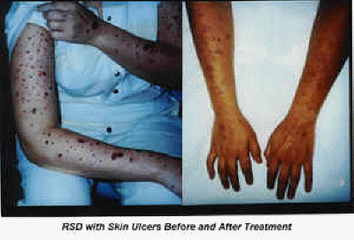 db_Lesions_Photos_copy1 (1)