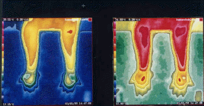db_Thermography_of_E_I_Patient1