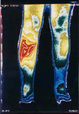 db_db_AVM-RSD_Thermography_copy11