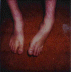 Leg and Foot Deformity-Discoloration Picture #1